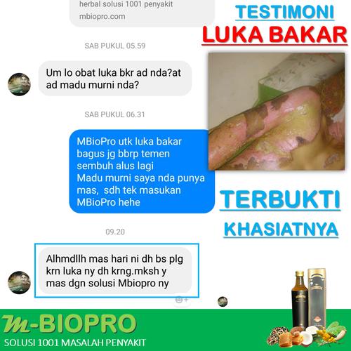 Foto Produk MBIOPRO Solusi untuk Mengatasi Luka Bakar dengan Cepat dan Ampuh dari Istiqomah-Store