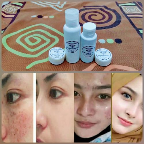 Jual Glowing Dalam 1 Minggu Paket Cream Pemutih Wajah Diamond Whitening Ori Jakarta Timur Dach Shop Tokopedia