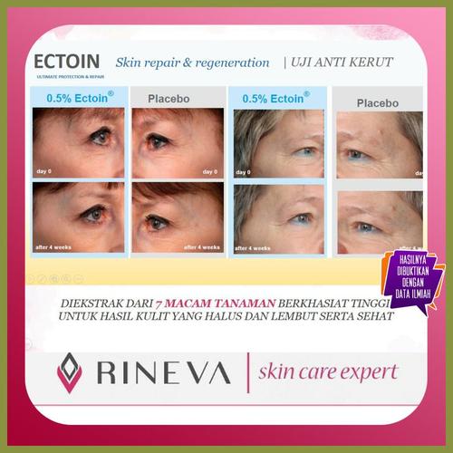 Foto Produk Penghilang Noda Wajah Skincare Care Korea Cruelty Free dari Si Cantik Alami