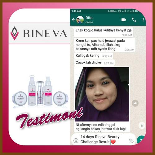 Foto Produk Paket Kecantikan Rineva Skincare Ekstrak Sea Daffodil dari Si Cantik Alami