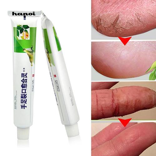 Jual Hn Krim Salep Tradisional Cina Untuk Perawatan Kulit Tangan Tumit Jakarta Barat Yoanmody Tokopedia