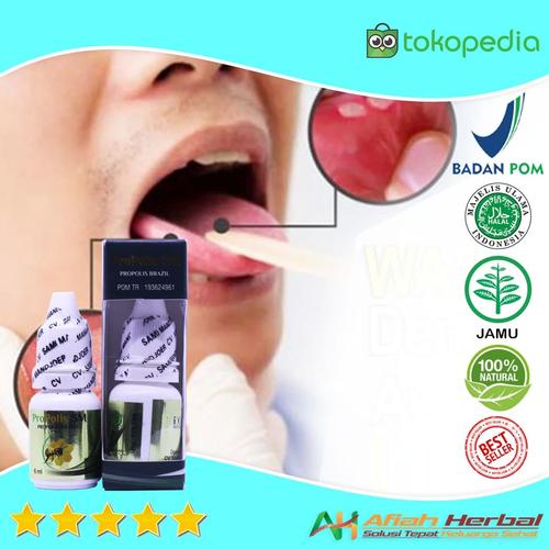 Jual Obat Sariawan Kualitas Super Sariawan Di Lidah Mulut Bibir Jakarta Pusat Afiah Herbal Tokopedia