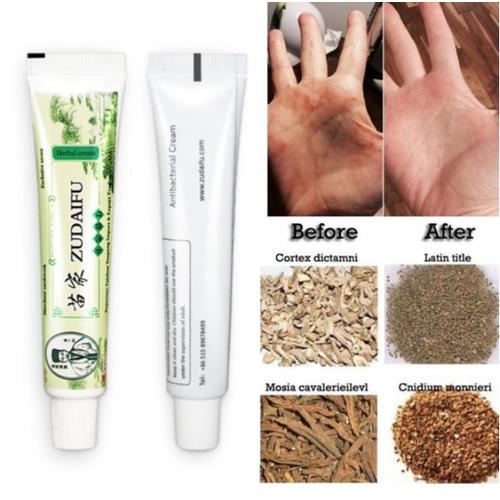 Gambar Zudaifu Original Cream Untuk Eksim Psoriasis Dermatitis Eksim J8U5 dari Alanna_Store Kota Tangerang Selatan Tokopedia