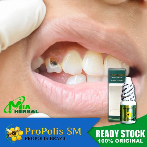 Jual Obat Sakit Gigi Berlubang Obat Gusi Bengkak Propolis Sm Kota Depok Mia Herbal Tokopedia