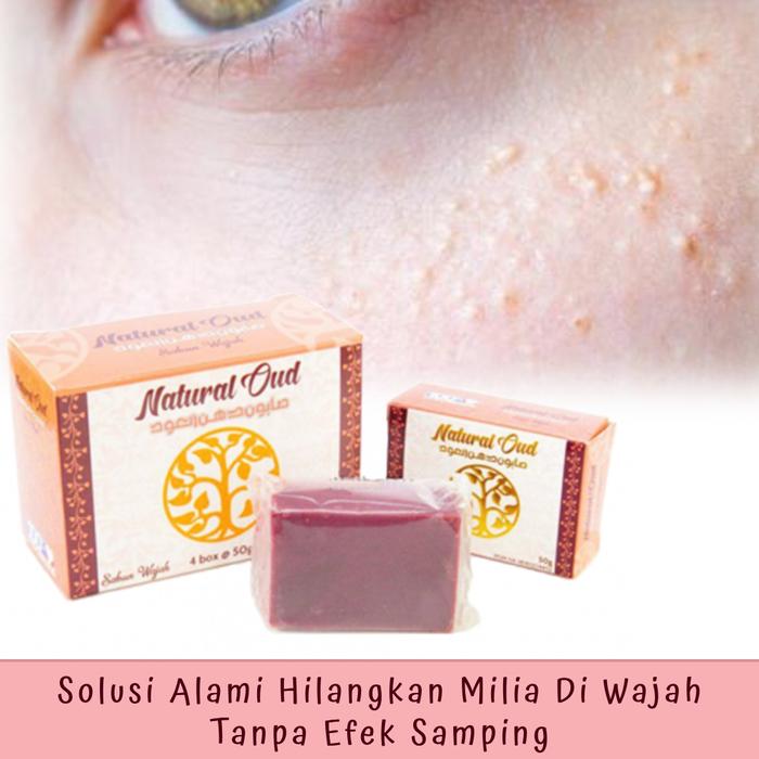 Jual Obat Untuk Menghilangkan Milia Di Wajah Sabun Cuci Muka Natural Oud Kota Tasikmalaya Azka Herbal Store Tokopedia