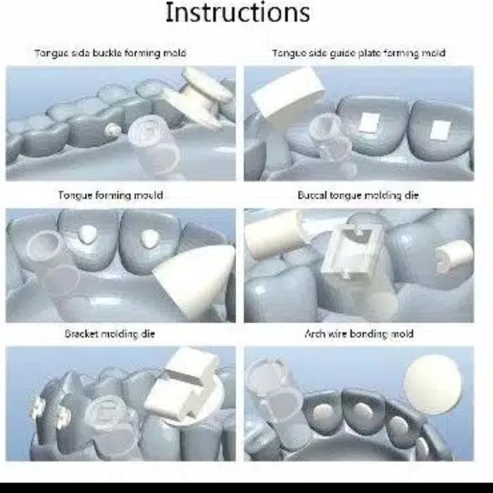 Gambar orthodontic mould starter kit ortho mold cetakan gigi lingual button dari sachioazizah undefined Tokopedia
