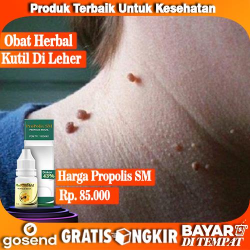 Jual Obat Kutil Di Leher Alami Obat Penumpas Kutil Propolis Sm Kab Bekasi Spotherbalindonesia Tokopedia