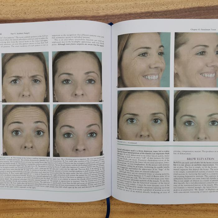 Jual Buku Kedokteran Grabb And Smith's Plastic Surgery 7e - Isi Hitam ...