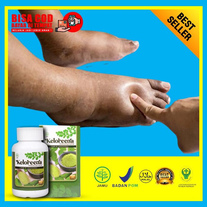 Gambar Obat Kaki Bengkak Herbal untuk Semua Usia Aman Tanpa Efek Samping dari Risman Herbal Semarang undefined Tokopedia