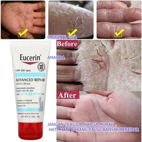 Gambar Eucerin Advanced Repair Hand Cream Ceramide Dry Skin Tangan Kering dari Amanda Beauty Care shop 888 undefined Tokopedia