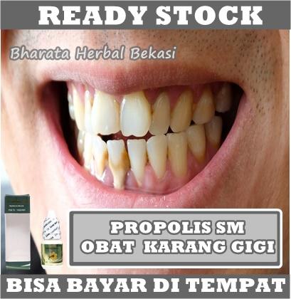 Gambar Obat Pemutih Gigi, Penghilang Plak Karang Gigi, Pembersih Gigi Kuning dari azqiaraherbal undefined Tokopedia