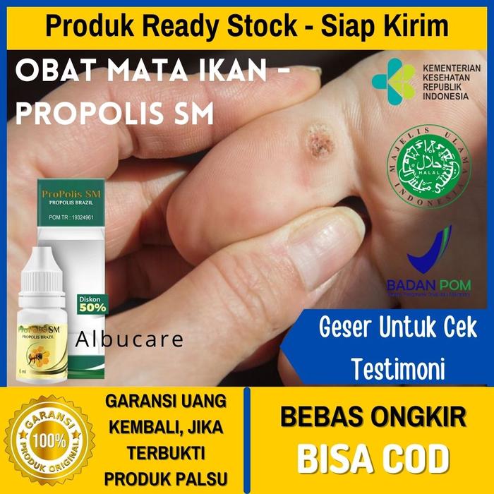 Gambar Obat Tetes Mata Ikan Di Telapak Kaki / Tangan -Kapalan Herbal Original - 1 botol dari JOBA STORE undefined Tokopedia