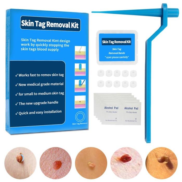 Gambar Auto Micro Skin Tag Remover ORIGINAL EHS - isi 10 pcs dari Everything Home Store undefined Tokopedia