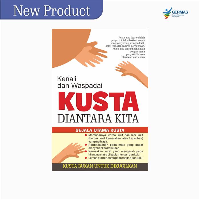 Gambar Poster Waspada Kusta, Poster Kusta, Poster Kesehatan - Poster A dari Sahabat Sejasa undefined Tokopedia