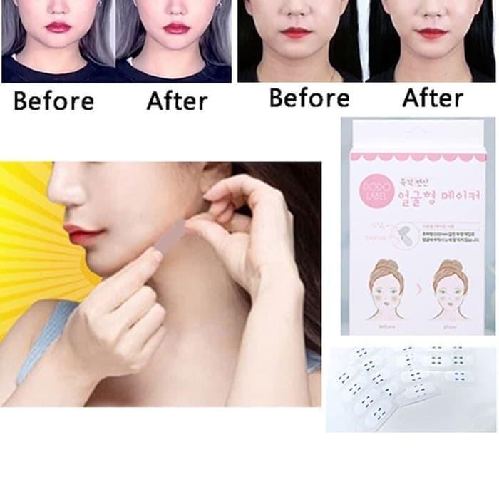 Double Chin Removal Malaysia