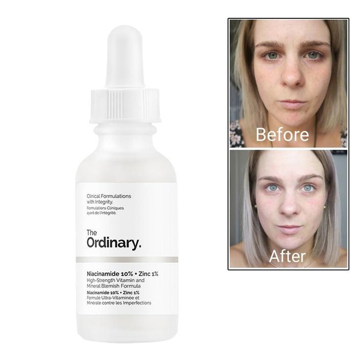 Gambar Serum Bekas Jerawat The Ordinary Niacinamide 10% + Zinc 1% 30ml - Niacinamide dari SS Brothers undefined Tokopedia