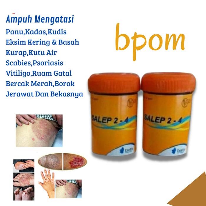 Gambar Salep Gatal Ampuh Eksim Kering-Obat Untuk kurap asli-Krim Gatal dari TokoKaka_str undefined Tokopedia