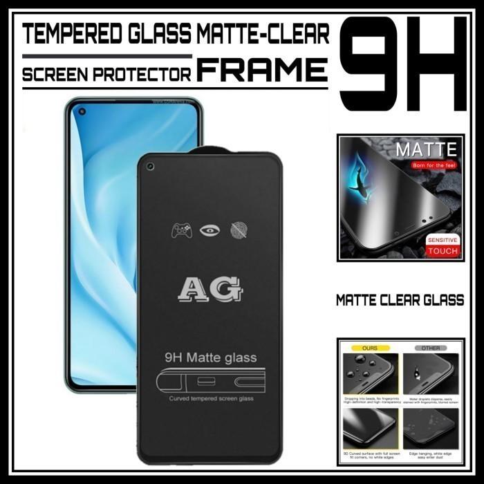 Daraz Pk Oppo A52 Back Cover Apple Screen Protector Phone Case For