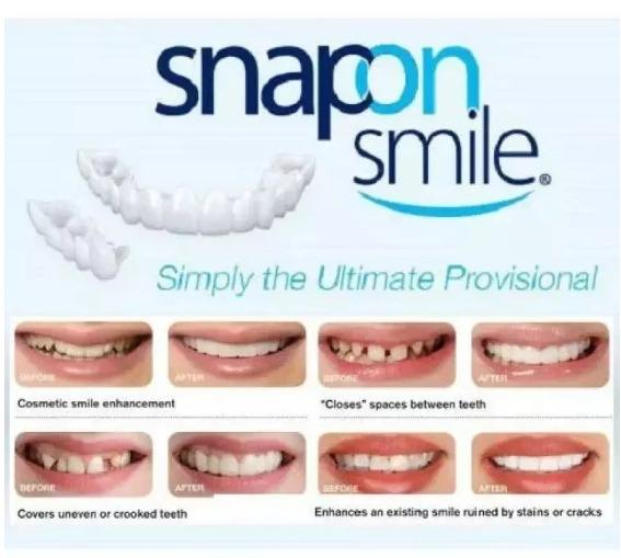 Gambar ORIGINAL SNAP ON SMILE Gigi Palsu model silikon ubah penampilan gigi dari Toserba HT undefined Tokopedia