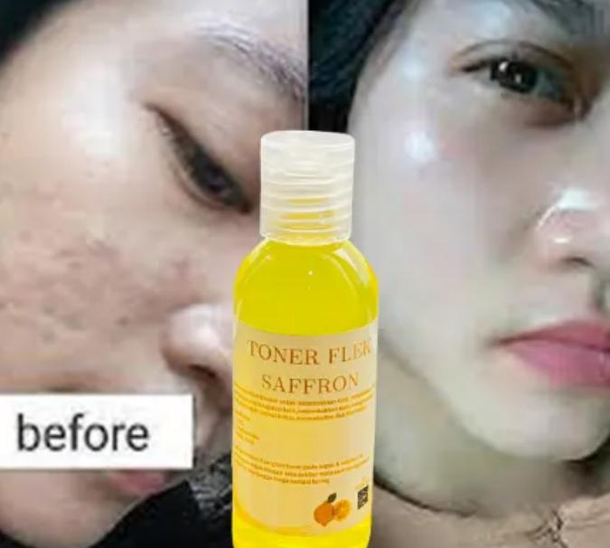 Gambar TONER FLEK SAFFRON - 60ml dari gitaskinoriofficial undefined Tokopedia