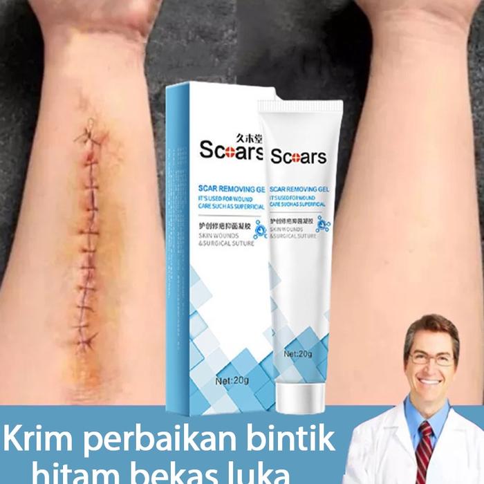 Gambar Dijamin Aman penghilang bekas luka obat penghilang bekas luka 20 - beli 2 gratis 1 dari Sekar On Store undefined Tokopedia