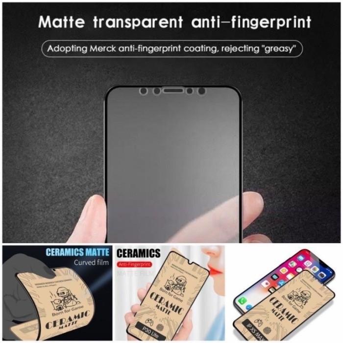 Gambar Case Xiaomi MI A2 Lite Softcase Macaron Pro Kamera Xiaomi MI A2 Lite - Antigores depan dari HMCASE OFFICIAL undefined Tokopedia