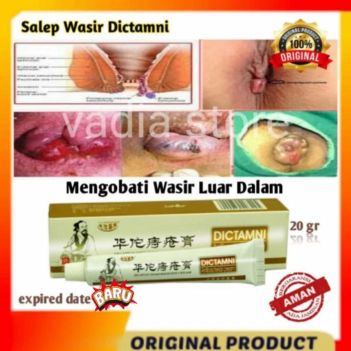 Gambar HUATUO Hemorrhoids cream salep obat wasir ampuh ambeien sembelit dari syihabvadia undefined Tokopedia