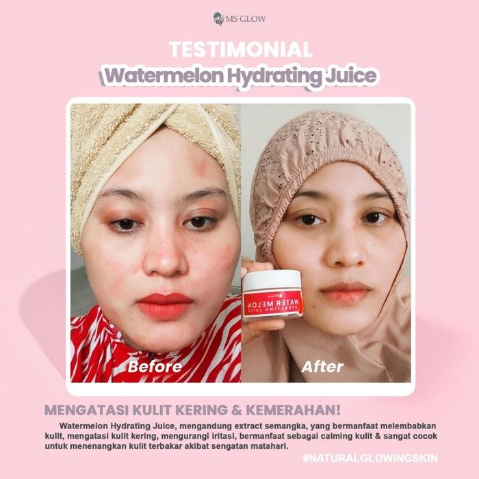 Gambar MS JUICE MOISTURIZER MS GLOW, WATERMELON, YUZU, GRAPE AND SHEED - WATER MELON dari Gudang Skincare Ms Glow undefined Tokopedia