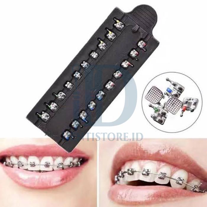 10-Pack Self-Ligating Metal Orthodontic Brackets – Mini Braces With Hooks, Roth .022" - View #2