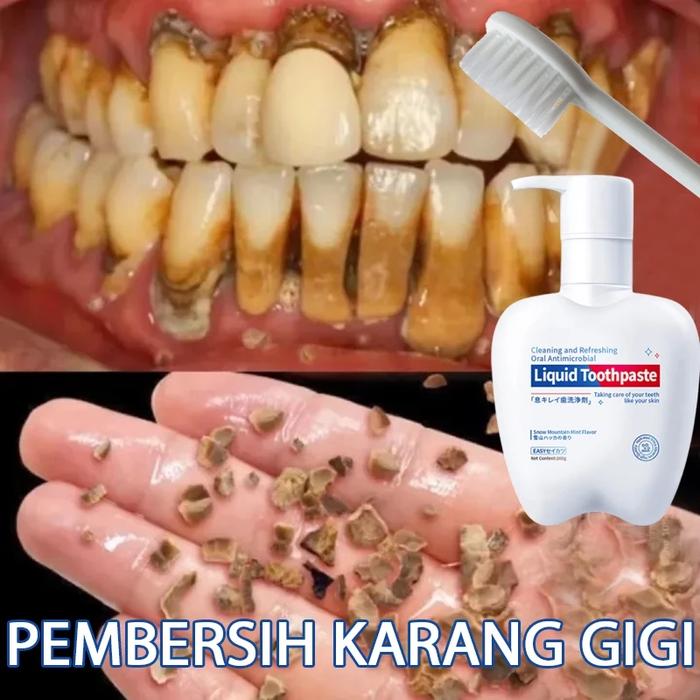 Gambar Odol pemutih gigi dan karang gigi penghilang karang gigi pasta gigi pemutih 200g alat pembersih karang gigi pembersih gigi kuning dari toko jasmann undefined Tokopedia