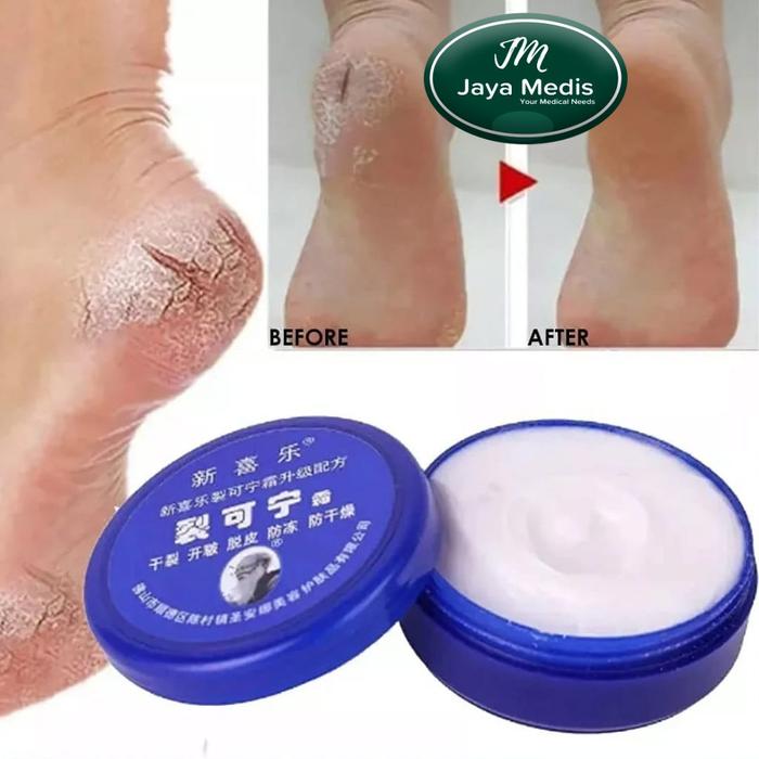 Gambar HERBAL FOOT CREAM - KRIM UNTUK MENGHALUSKAN DAN MELEMBUTKAN TUMIT KAKI dari Jayamedis undefined Tokopedia