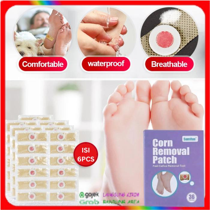 Gambar Foot Corn Removal Patch Plester Koyo Ampuh Hilangkan Kutil Mata Ikan dari DakenShopp undefined Tokopedia
