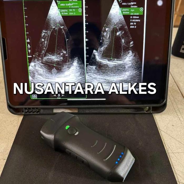Gambar USG/ ULTRASOUND WIRELESS/ PORTABLE/ PORTABEL/ POCKET/ DOUBLE HEAD/ USG WIFI CARDIAC/ LINIER/ CONVEX/ VASCULARIS/ OBGYN/ PASHED ARRAY/ OBSTETRIC  3 IN 1 MURAH BERGARANSI 2 TAHUN - C10TX dari Nusantara Alkes undefined Tokopedia