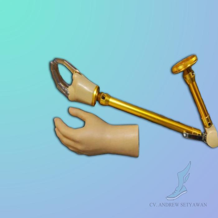 Gambar Tangan Palsu Atas Siku /  Tangan Palsu - Komponen Impor2 dari ANDREW SETYAWAN_NEW undefined Tokopedia