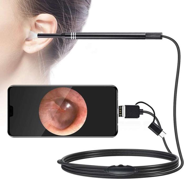 Gambar Kamera Pembersih telinga otoscope korek kuping USB micro USBwax Removal Perawatan Ear Cleaning Hitam - kabel 3in1 dari Northestco undefined Tokopedia