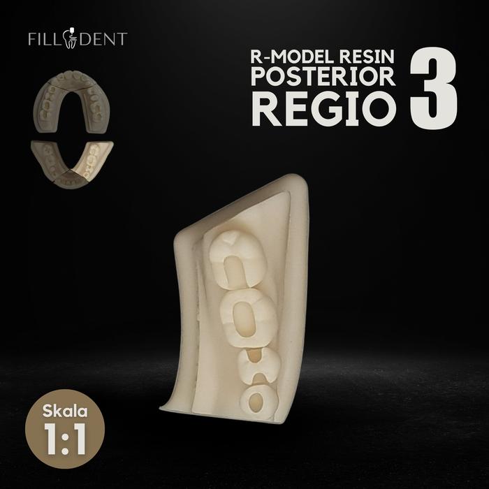 Gambar R-Model Resin Posterior |Model Kerja Kedokteran Gigi Restorasi - REGIO 3 dari Filladent undefined Tokopedia