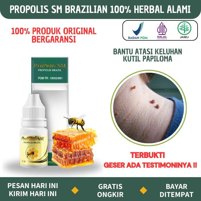 Gambar Obat Kutil, Papiloma, Daging Tumbuh, Kutil Di Leher Dan Wajah Propolis dari Surabaya Herbal Store undefined Tokopedia