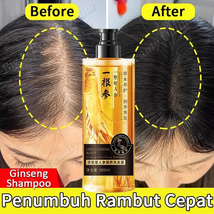 Gambar Sampo Ginseng Shampo Penumbuh Rambut Cepat Anti rambut rontok Botak ginger shampoo 300 ml dari toko jasmann undefined Tokopedia