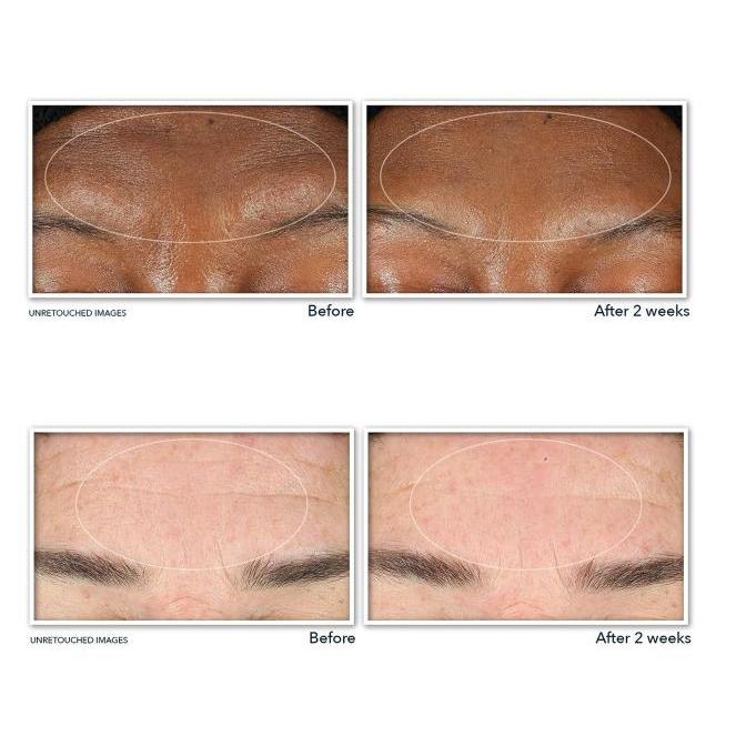 Gambar Roc Retinol Correxion Anti Aging Deep Wrinkle Serum Cleanser, 177Ml Original 100% dari Cantikalauren undefined Tokopedia