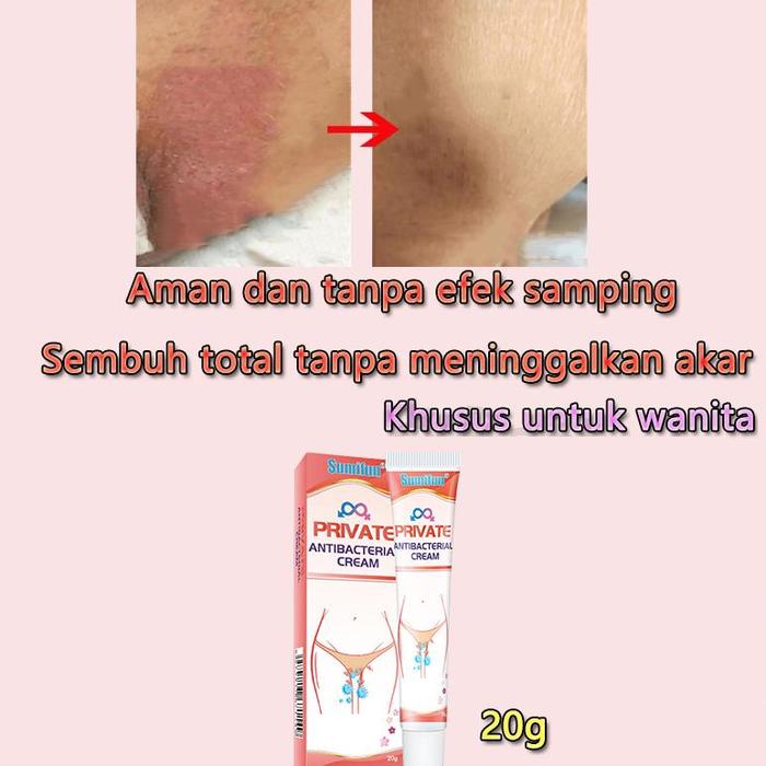 Gambar （Barang asli）salep gatal - obat gatal selangkangan - salep gatal paling ampuh 20g Pemutih Selangkangan, Infeksi Jamur, Gatal Pada Kemaluan aman dan tanpa efek samping, sembuh total tanpa meninggalkan akar - beli 1 (A) dari Diki Barewinal undefined Tokopedia