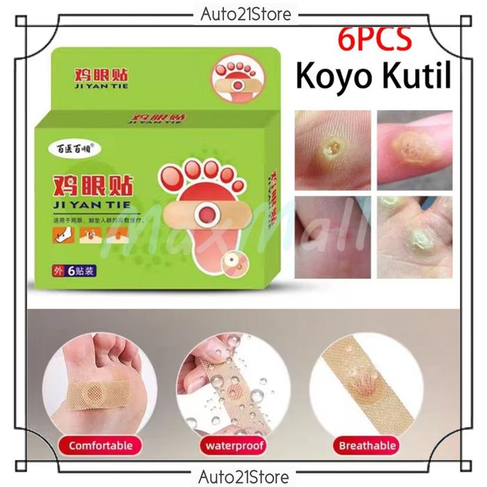 Gambar Obat CABUT KUTIL[ 1 BOX 6 PCS ] Plester Kutil Mata Ikan Ampuh Menghilangkan Kapalan Mata Kaki - 1 dari Auto21Store undefined Tokopedia
