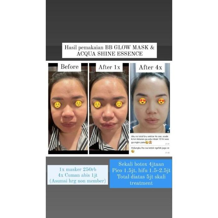 Gambar [Termurah] Trial Masker Bb Glow And Serum Le Acquashine Water Botox At Home Pengencang Wajah Favoured One dari DalamoStore undefined Tokopedia