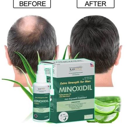 Gambar MINOXIDIL 5% penumbuh rambut & brewok with Aloe Vera for MEN made in USA - RAYGOLD - MINOX MINOKSIDIL anti rontok & kebotakan dari LUMBAR OFICIAL undefined Tokopedia