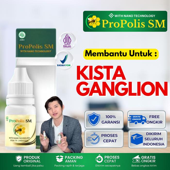 Gambar Propolis SM Obat Herbal untuk Menghilangkan Benjolan di Tangan dan Pergelangan Tangan dari Khal Herbal undefined Tokopedia