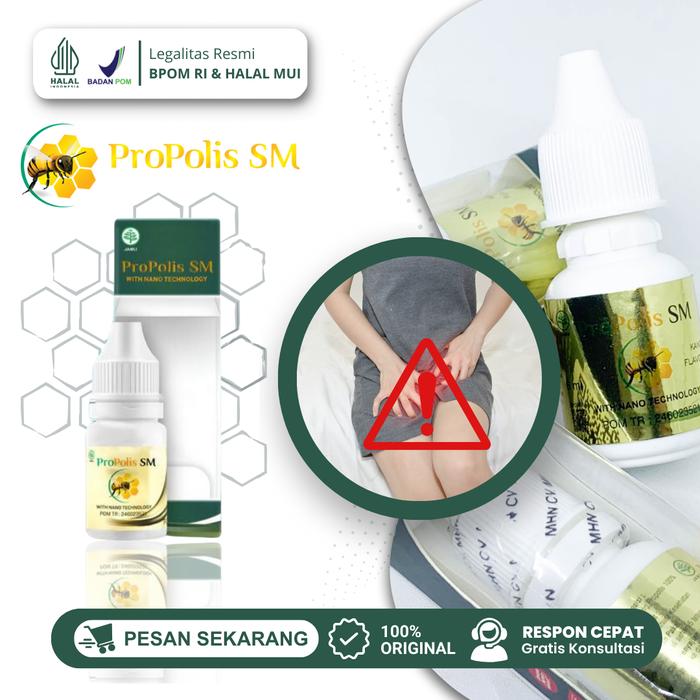 Gambar Propolis SM Oles Gatal Selangkangan, Gatal Ke lamin, Selankangan Berjamur Hitam dan Lecet dari Nana Herb Store undefined Tokopedia