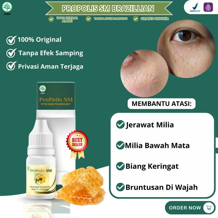 Gambar Propolis SM Cairan Untuk Milia Penghilang Milia Alami Hilangkan Milia Di Bawah Mata Bintik Putih Di Sekitar Mata dari DanielHerbalShop undefined Tokopedia