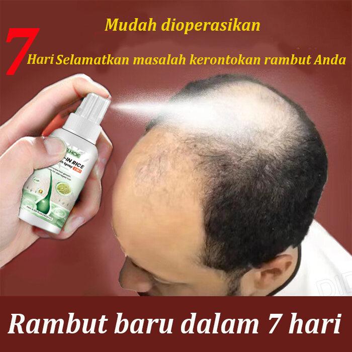 Gambar penumbuh dan perawatan Penumbuh Rambut Secara Cepat 100ml Obat Penumbuh Rambut Botak Super Cepat /Penyubur Rambut Rontok Pria Minyak Rambut Kemiri Asli Asli dari Jisis toko 03 undefined Tokopedia