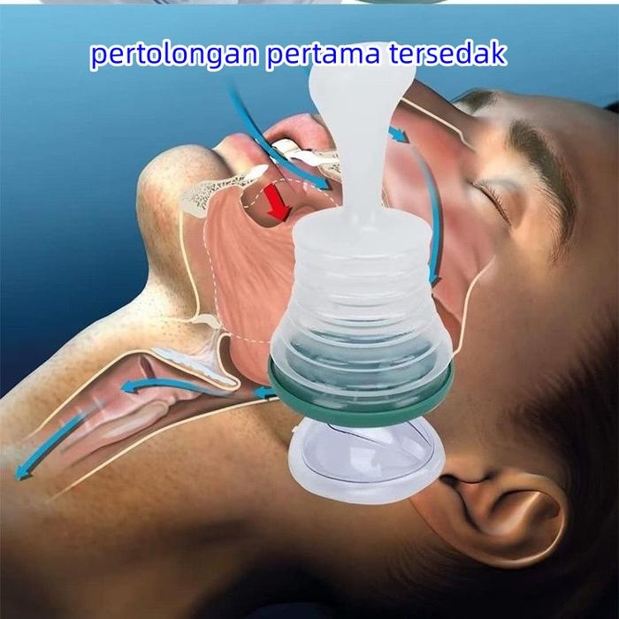 Gambar 1set Choking Rescue Emergency Device Perangkat Penyelamat Pencekik Untuk Anak Dewasa dari Anggun Indonesia Official ID undefined Tokopedia