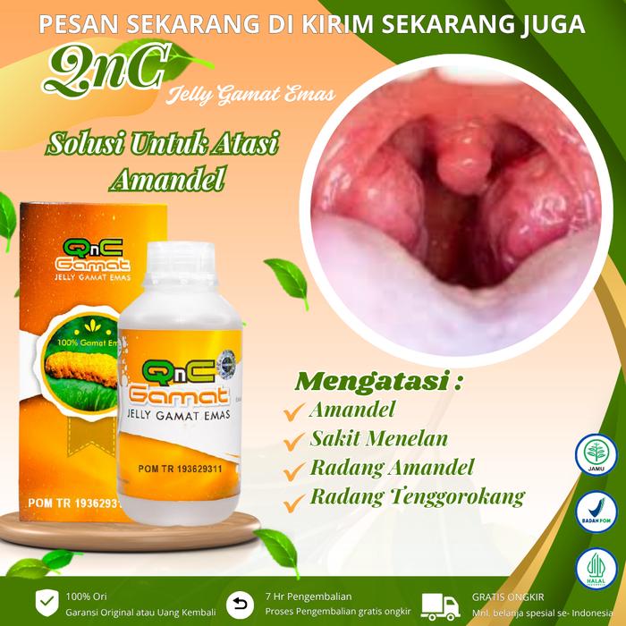Gambar Solusi Untuk Sakit Amandel, Radang Tenggorokan, Batuk Kering, Susah Sulit Menelan, Infeksi Amandel, Amandel Akut dan Kronis, Tonsilitis Akut Kronis, obat penghancur amandel Dengan QnC Jelly Gamat Emas dari madayastore undefined Tokopedia