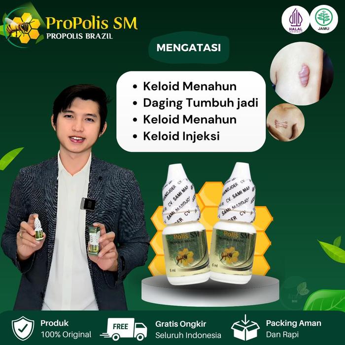 Gambar Menghilangkan Benjolan Keloid Menahun Daging Tumbuh Bekas Luka Operasi Injeksi Di Semua Area Tubuh Dengan Propolis SM dari Azwa Herbal Shop undefined Tokopedia